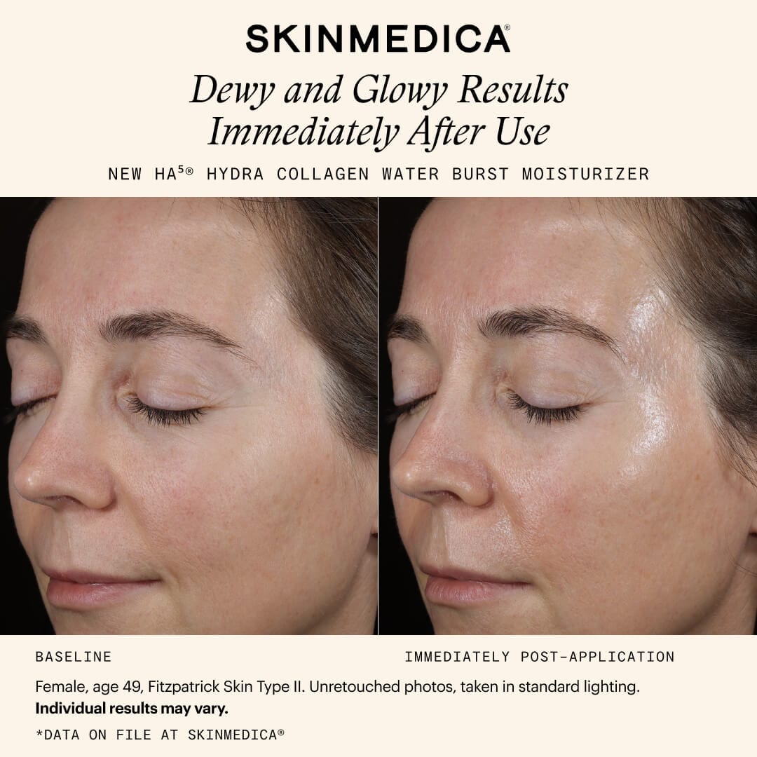 SkinMedica Face Moisturizers SkinMedica HA5 Hydra Collagen Water Burst Moisturizer - Skin Type Solutions