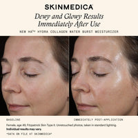 SkinMedica Face Moisturizers SkinMedica HA5 Hydra Collagen Water Burst Moisturizer - Skin Type Solutions