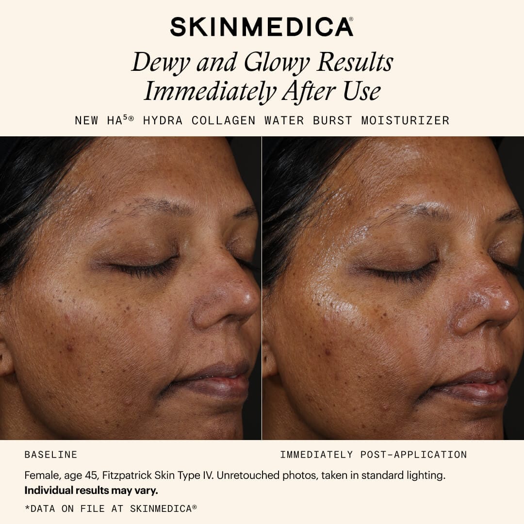 SkinMedica Face Moisturizers SkinMedica HA5 Hydra Collagen Water Burst Moisturizer - Skin Type Solutions