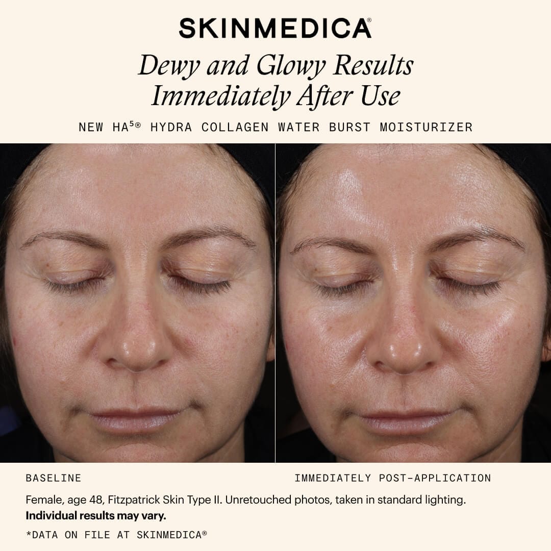 SkinMedica Face Moisturizers SkinMedica HA5 Hydra Collagen Water Burst Moisturizer - Skin Type Solutions
