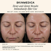 SkinMedica Face Moisturizers SkinMedica HA5 Hydra Collagen Water Burst Moisturizer - Skin Type Solutions