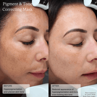 SENTE Facial Treatment 1.7 fl. oz. Sente Cysteamine HSA Pigment & Tone Corrector - Skin Type Solutions