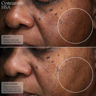 Sente Cysteamine HSA Pigment & Tone Corrector