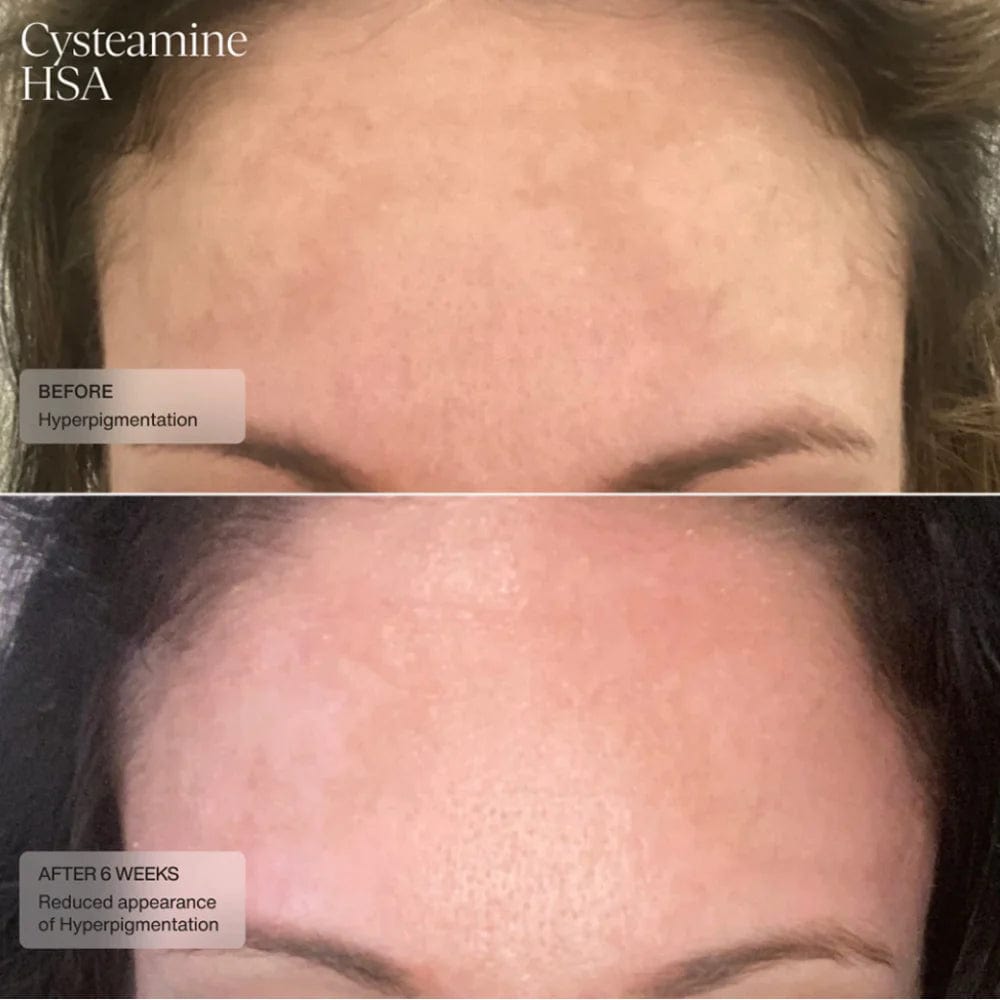 Sente Cysteamine HSA Pigment & Tone Corrector