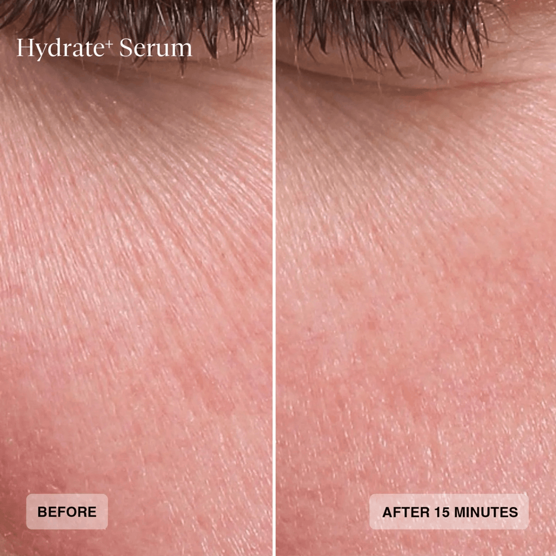 SENTE SkinCare 1 oz Sente© Hydrate+ Serum - Skin Type Solutions