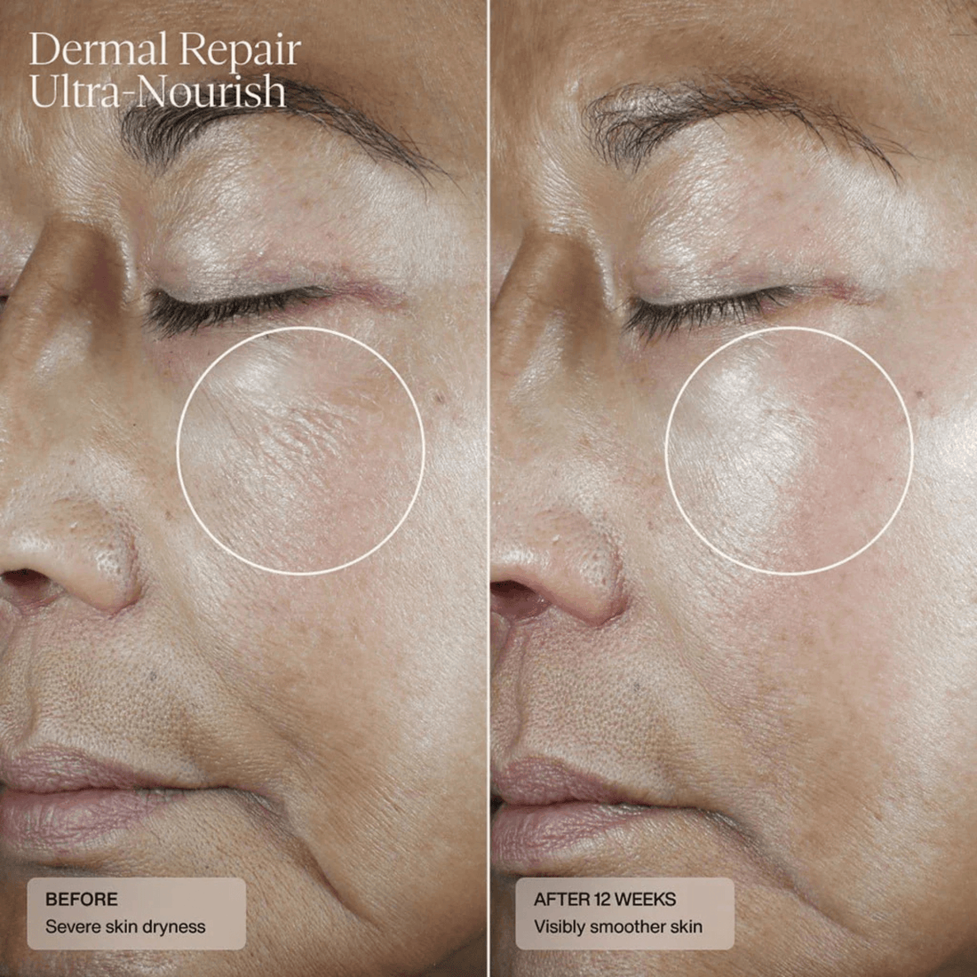SENTE Facial Moisturizer 1.7 oz. Sente Dermal Repair Ultra-Nourish Creme - Skin Type Solutions