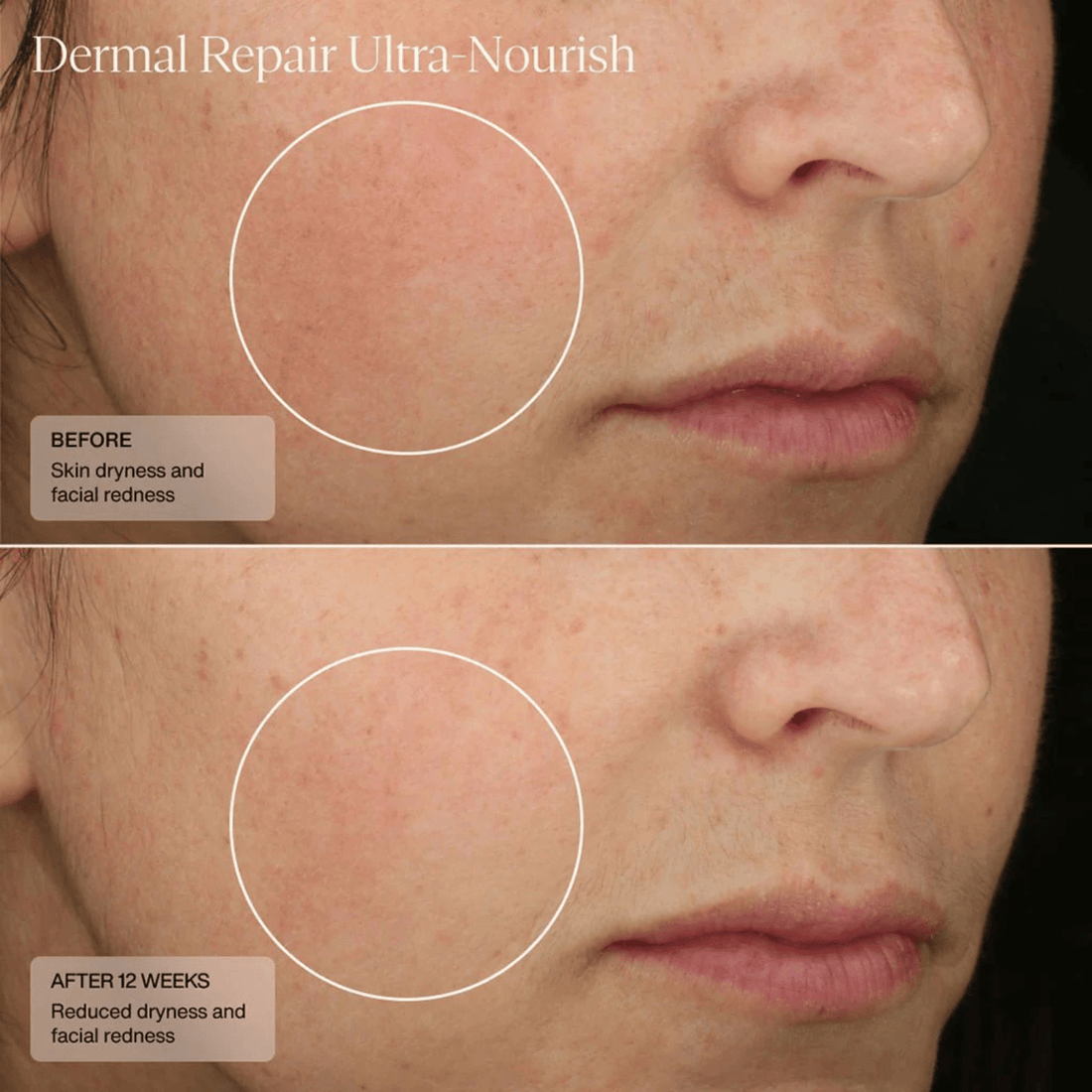 SENTE Facial Moisturizer 1.7 oz. Sente Dermal Repair Ultra-Nourish Creme - Skin Type Solutions