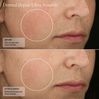 SENTE Facial Moisturizer 1.7 oz. Sente Dermal Repair Ultra-Nourish Creme - Skin Type Solutions