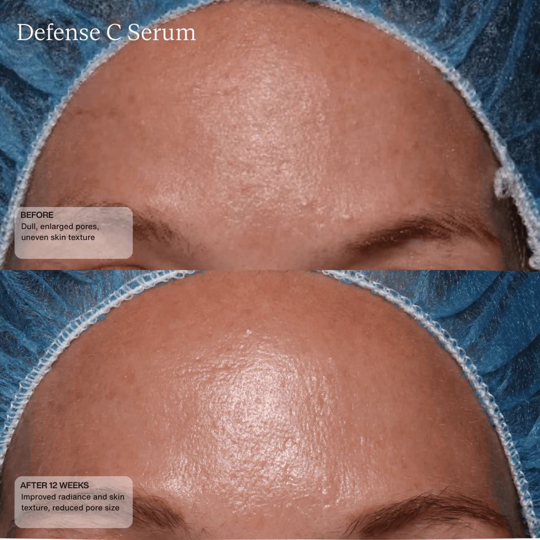 SENTE Treatments & Serums Sente Defense C Serum - Skin Type Solutions