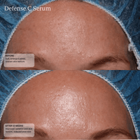 SENTE Treatments & Serums Sente Defense C Serum - Skin Type Solutions