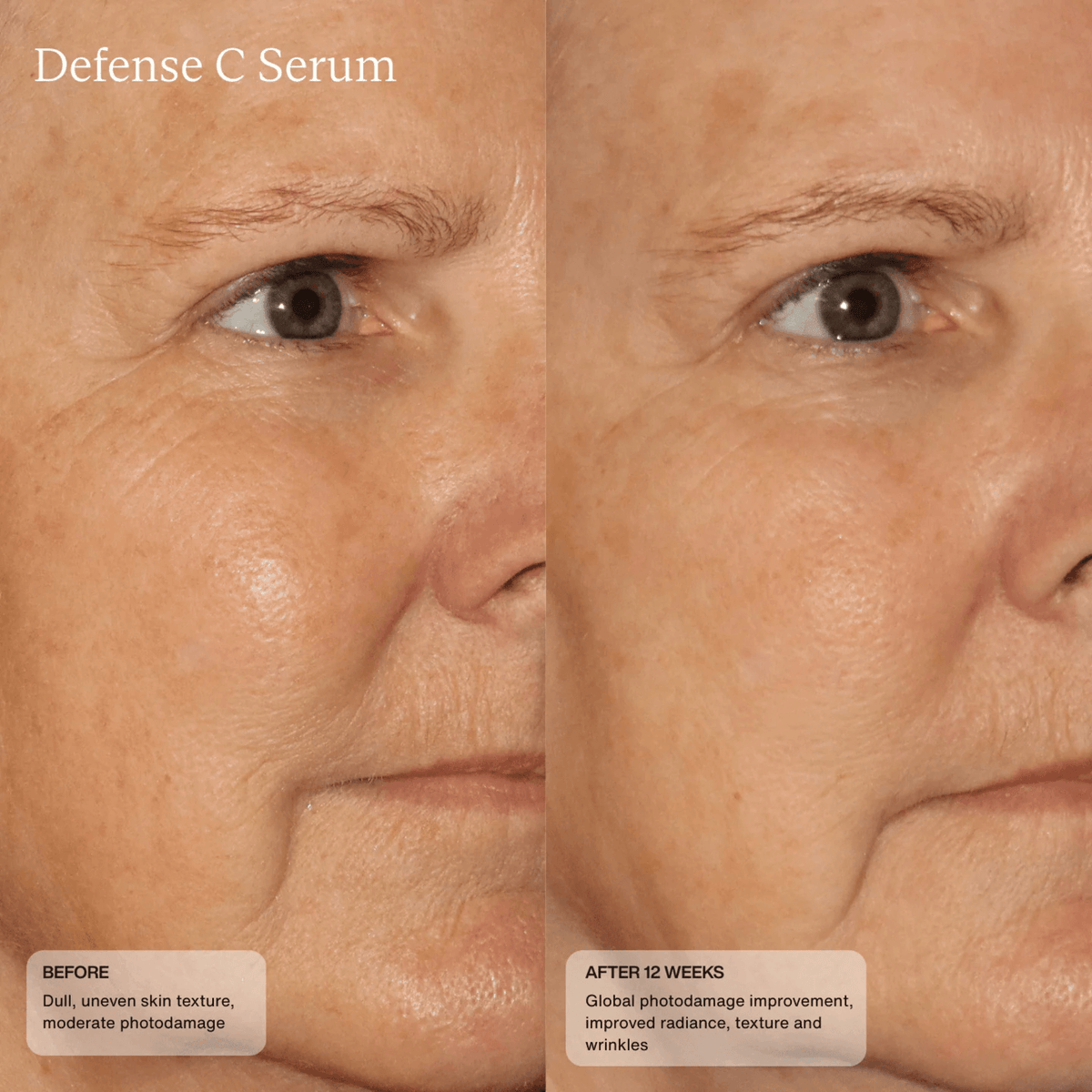 SENTE Treatments & Serums Sente Defense C Serum - Skin Type Solutions