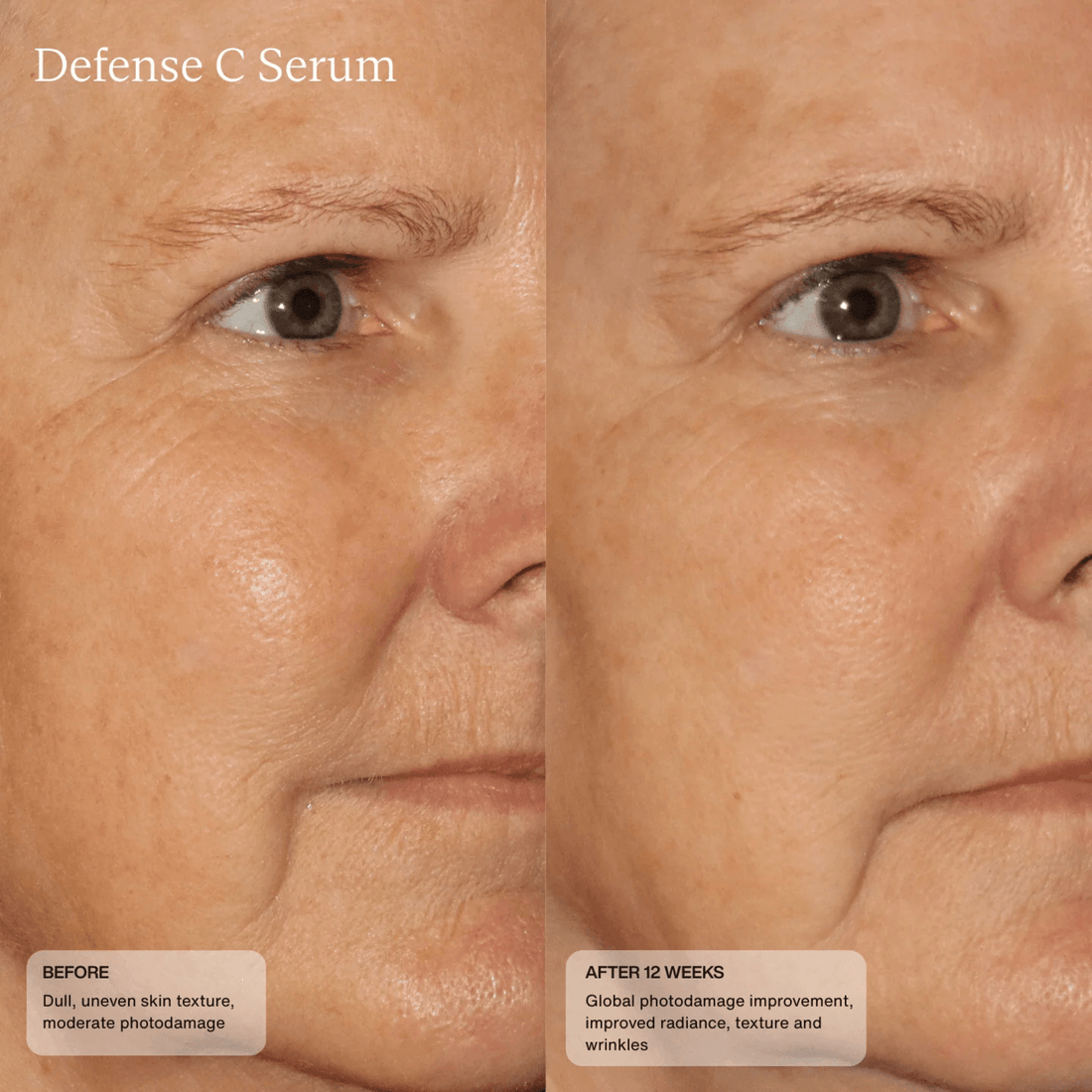 SENTE Treatments & Serums Sente Defense C Serum - Skin Type Solutions