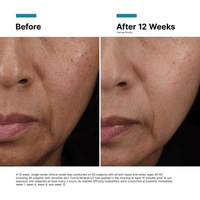 SkinCeuticals Sunscreen SkinCeuticals Future Mineral UV Defense Sunscreen SPF 50 - Skin Type Solutions