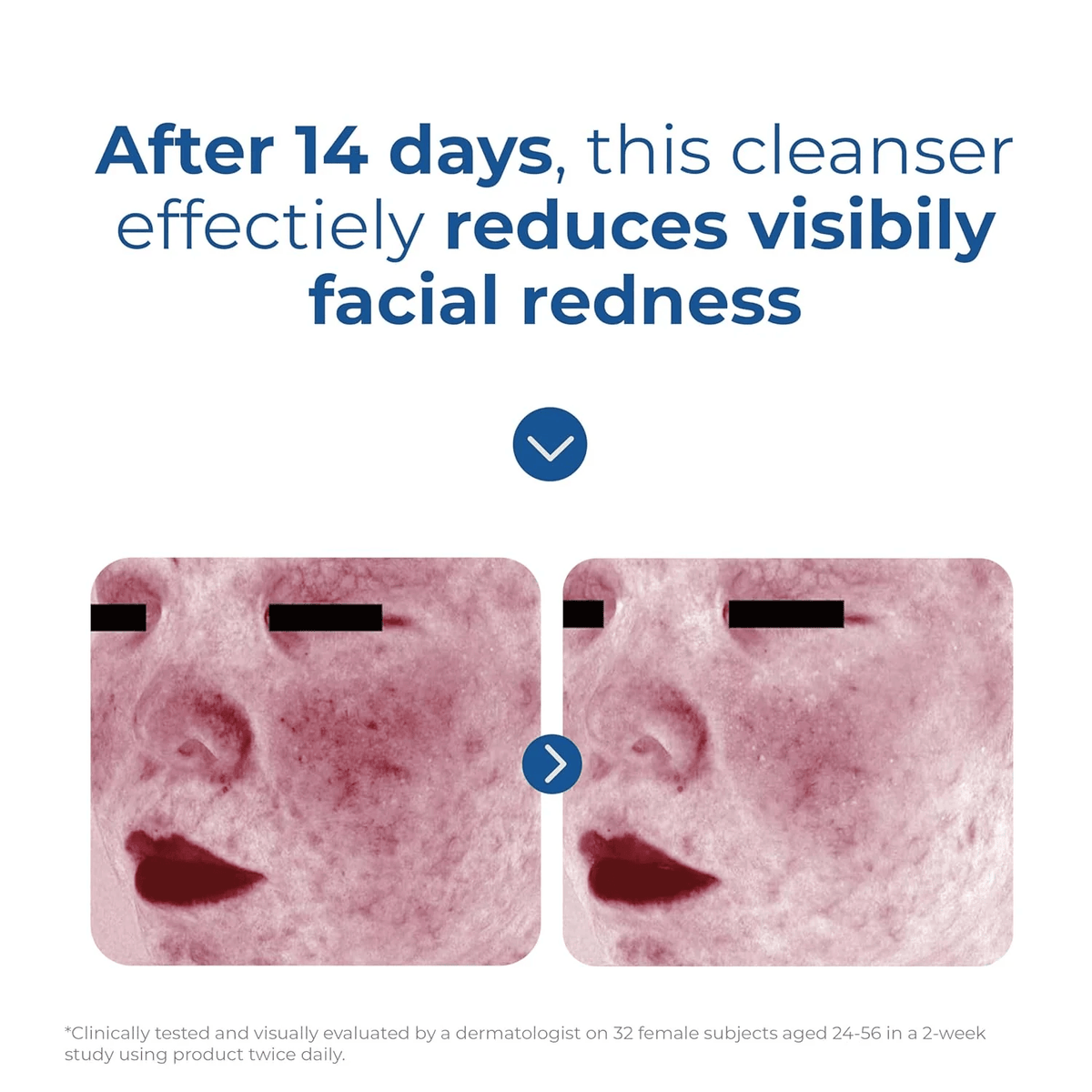 EltaMD SkinCare EltaMD Skin Recovery Amino Acid Foaming Cleanser - Skin Type Solutions