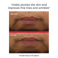 EltaMD Sunscreen EltaMD UV Daily Hydration+ Broad Spectrum SPF 50 1.7oz - Skin Type Solutions