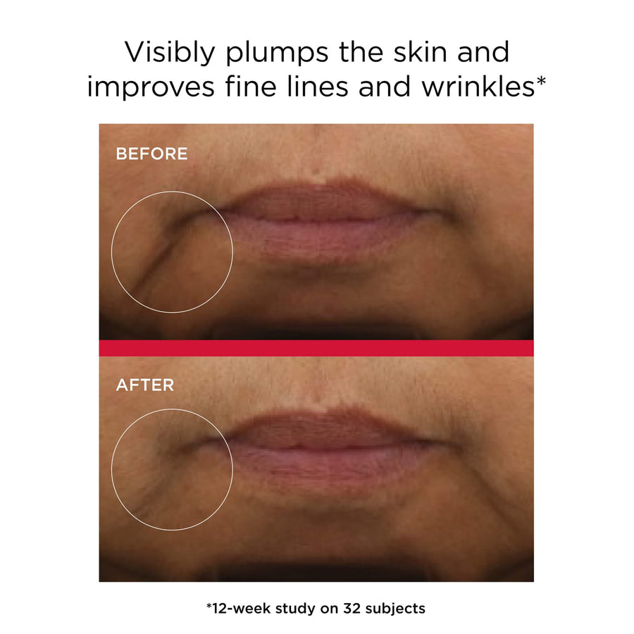 EltaMD Sunscreen EltaMD UV Daily Hydration+ Broad Spectrum SPF 50 1.7oz - Skin Type Solutions