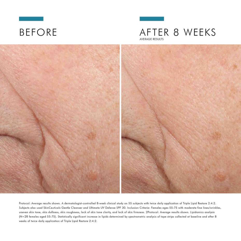 SkinCeuticals Facial Moisturizer 1.6 fl. oz. SkinCeuticals Triple Lipid Restore 2:4:2 - Skin Type Solutions