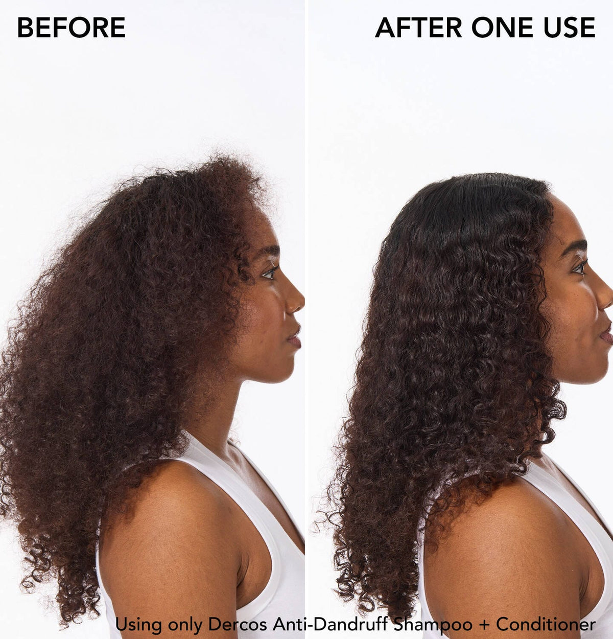 Vichy Scalp Treatment Vichy Anti-Dandruff Hydrating Scalp + Hair Conditioner - Skin Type Solutions