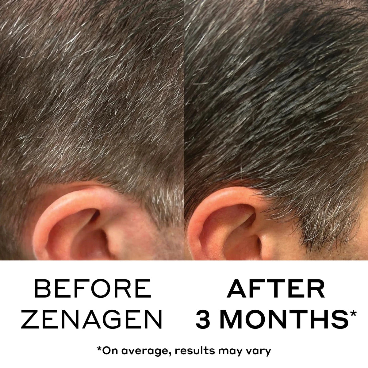 Zenagen Shampoo Zenagen ECLIPSE Color Preservation Shampoo - Skin Type Solutions