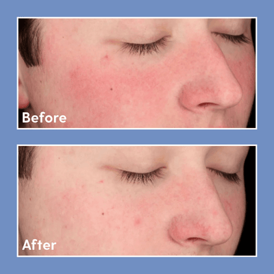 Bright Girl Bright Tone Hydrating Toner