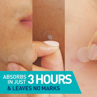 Cerave Facial Treatment CeraVe Acne Control patches - Skin Type Solutions