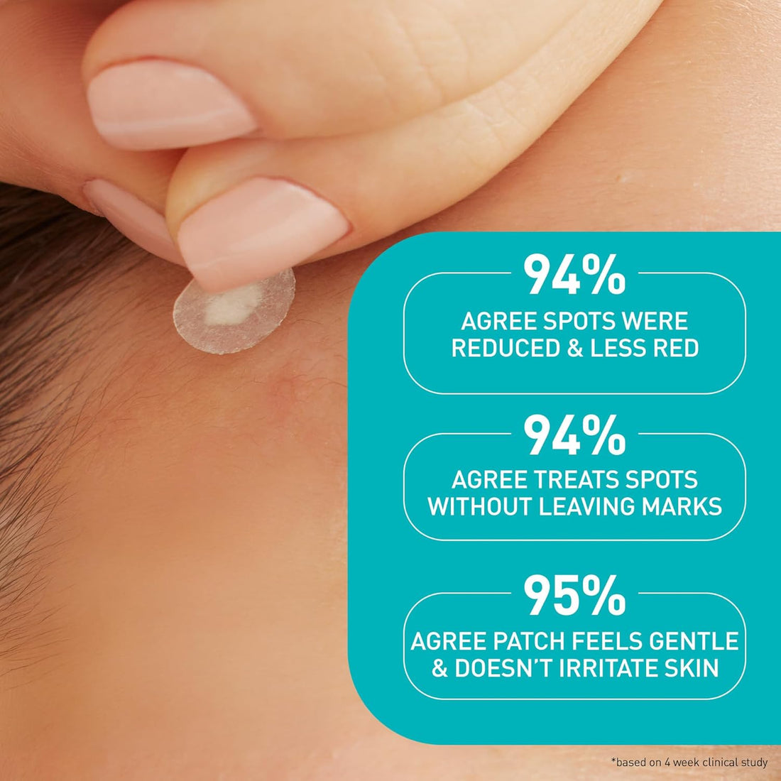 Cerave Facial Treatment CeraVe Acne Control patches - Skin Type Solutions