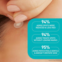 Cerave Facial Treatment CeraVe Acne Control patches - Skin Type Solutions