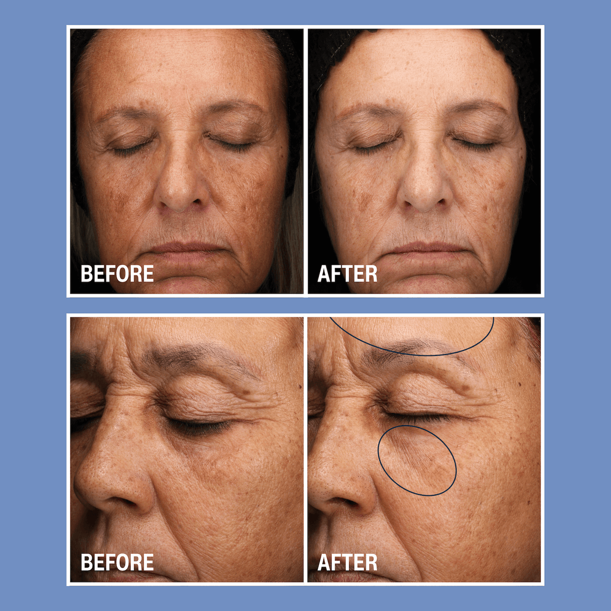 Cyspera SkinCare 1 oz. Cyspera Boost - Skin Type Solutions