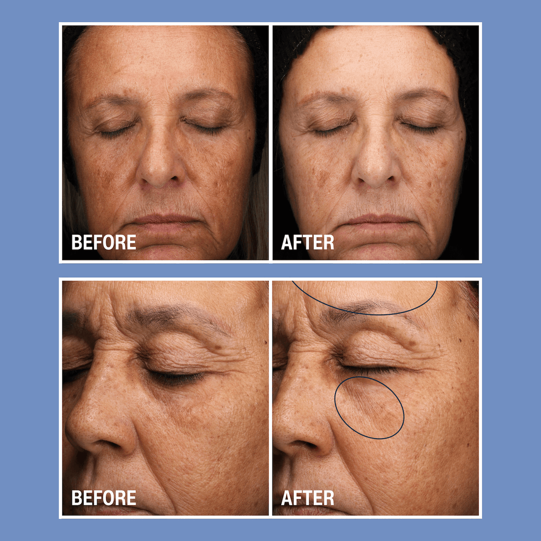 Cyspera SkinCare 1 oz. Cyspera Boost - Skin Type Solutions