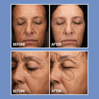 Cyspera SkinCare 1 oz. Cyspera Boost - Skin Type Solutions