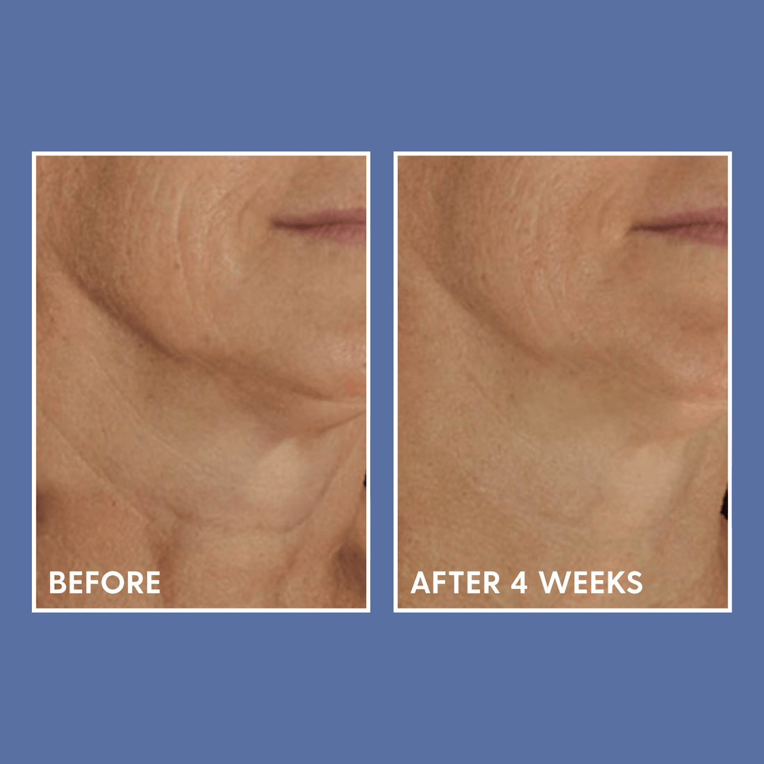 DefenAge Face & Body Treatment 1.5 fl. oz. DefenAge 6-week Perfection Neck Cream - Skin Type Solutions