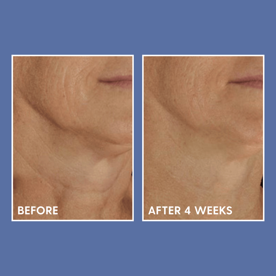 DefenAge Face & Body Treatment 1.5 fl. oz. DefenAge 6-week Perfection ...