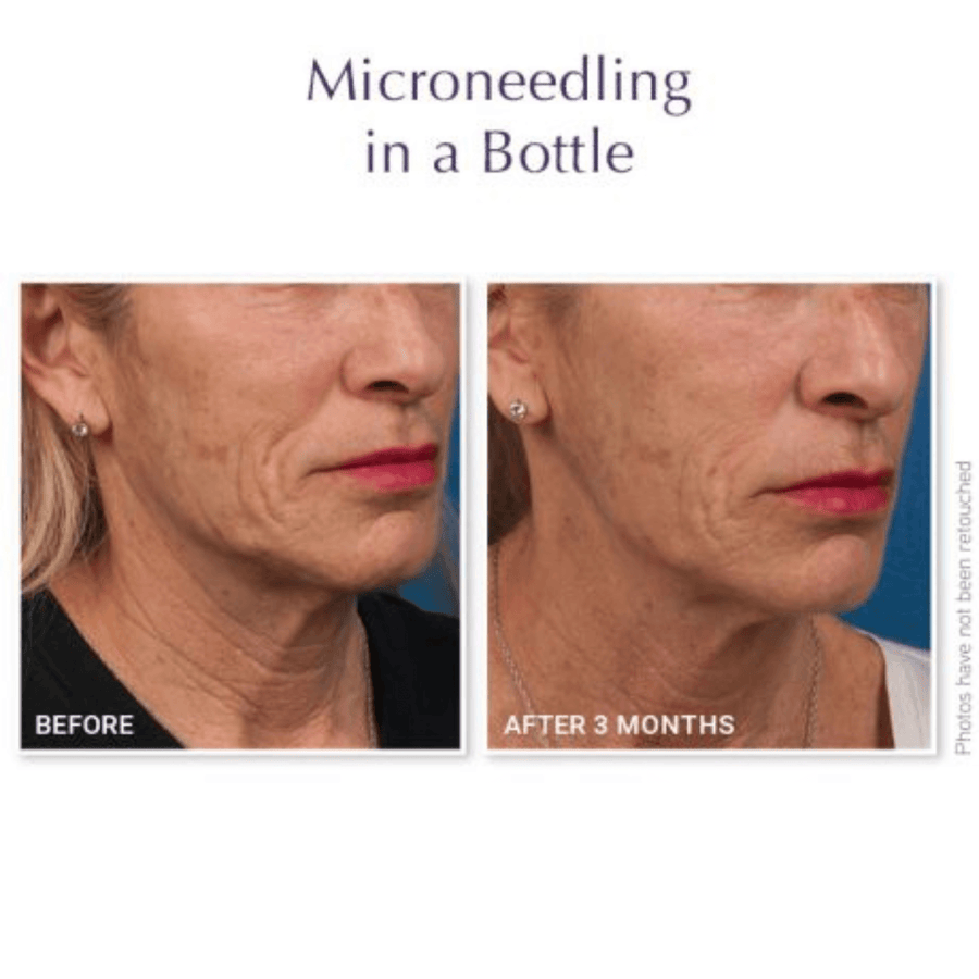DefenAge Facial Moisturizer 1.5 fl. oz. DefenAge 8-in-1 BioSerum Anti ...