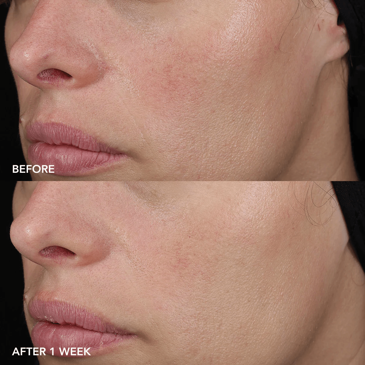 Image Skincare Face Moisturizers IMAGE Skincare IMAGE MD Barrier Repair Recovery Balm - Skin Type Solutions