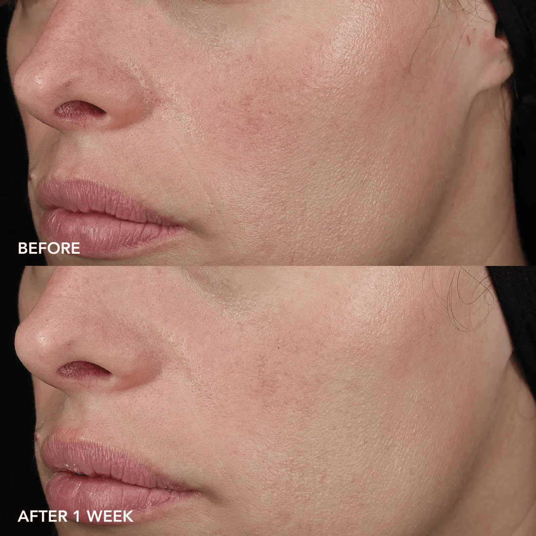 Image Skincare Face Moisturizers IMAGE Skincare IMAGE MD Barrier Repair Recovery Balm - Skin Type Solutions