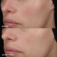 Image Skincare Face Moisturizers IMAGE Skincare IMAGE MD Barrier Repair Recovery Balm - Skin Type Solutions