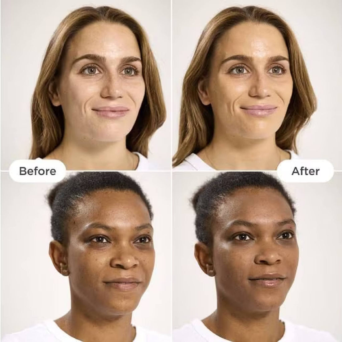 A white bottle of ISDIN Eryfotona Actinica Tinted Lightweight Emulsion Sunscreen SPF 50, skin type solutions before and after