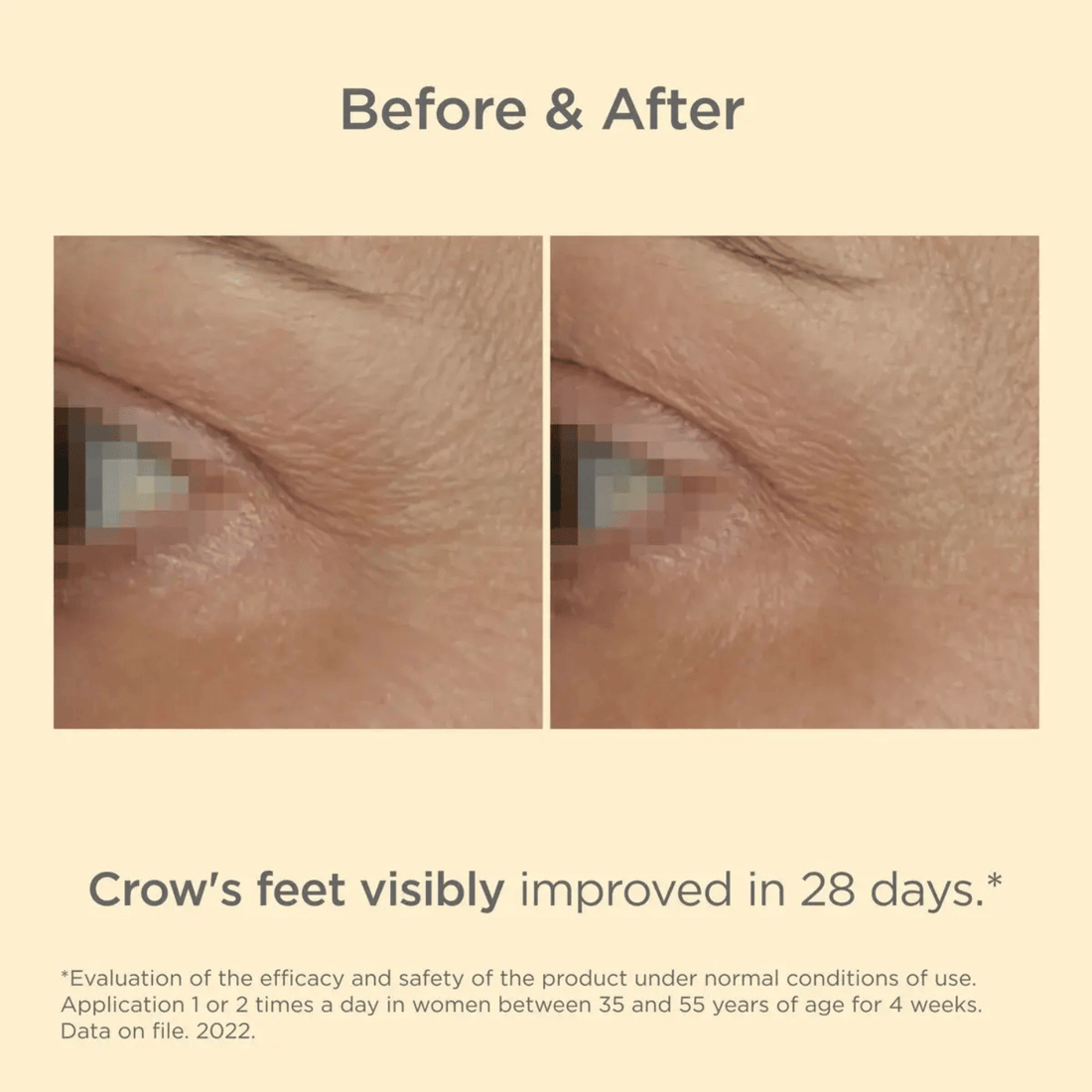 ISDIN Eye Treatment 0.53 oz. ISDIN Isdinceutics Vital Eyes - Skin Type Solutions