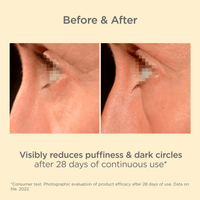 ISDIN Eye Treatment 0.5 fl. oz. ISDIN K-OX Eyes - Skin Type Solutions