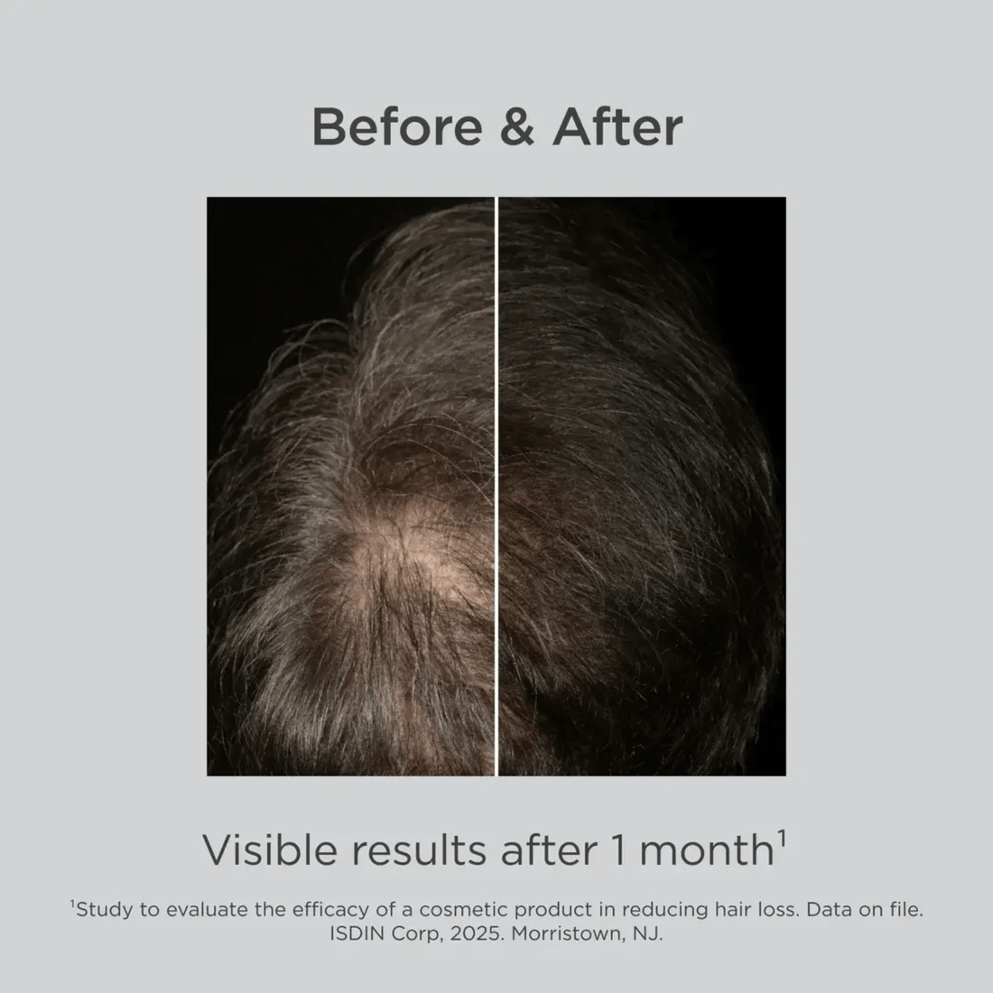 ISDIN Hair Conditioner ISDIN Lambdapil Hair Density Lotion with Melatonin - Skin Type Solutions