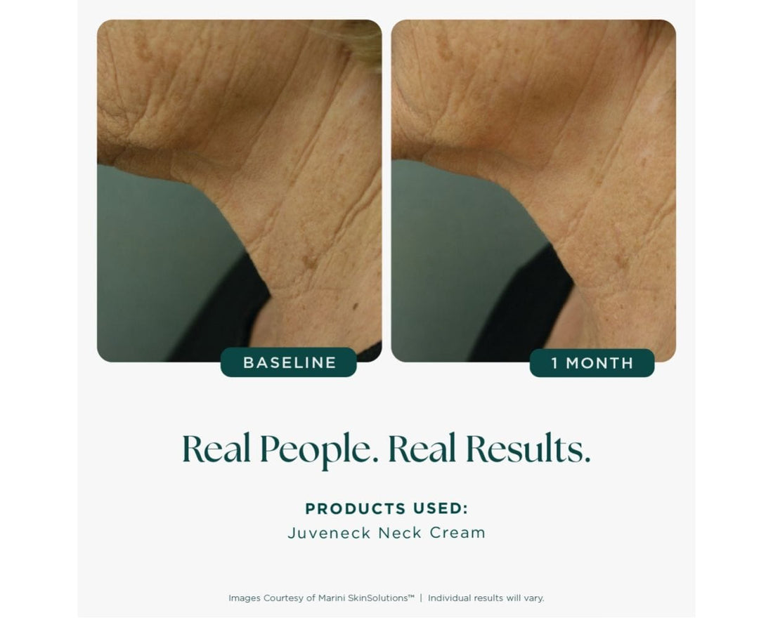 Jan Marini Face & Body Treatment 2.0 fl. oz. Marini skin solutions Juveneck cream - Skin Type Solutions