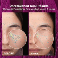 Medature Face & Body Treatment 15 ML Medature Encapsulated Retinol Serum - Skin Type Solutions