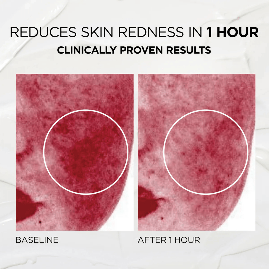 Medature SkinCare 0.5 fl. oz. (15 ml) Medature PSL Repair Moisturizer Trial Size - Skin Type Solutions