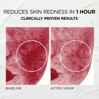 Medature SkinCare 0.5 fl. oz. (15 ml) Medature PSL Repair Moisturizer Trial Size - Skin Type Solutions
