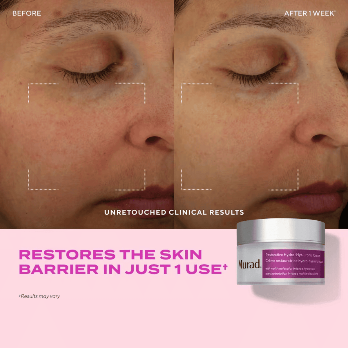 Murad Facial Cleanser Murad Restorative Hydro-Hyaluronic Moisture Cream - Skin Type Solutions
