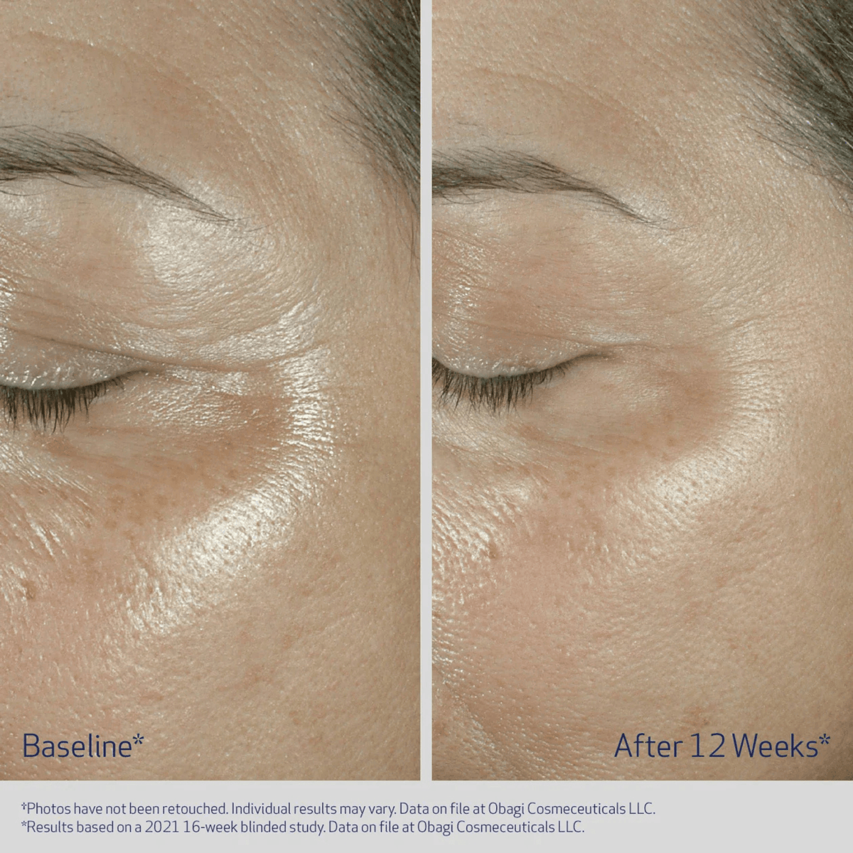 Obagi Eye Treatment 0.5 fl. oz. Obagi ELASTIderm Eye Cream - Skin Type Solutions