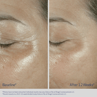 Obagi Eye Treatment 0.5 fl. oz. Obagi ELASTIderm Eye Cream - Skin Type Solutions