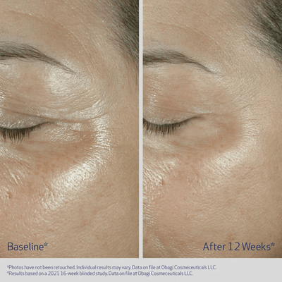 Obagi ELASTIderm Eye Cream