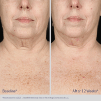 Obagi Body Moisturizer Obagi ELASTIderm Neck and Decollete Concentrate - Skin Type Solutions