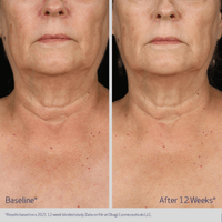 Obagi Body Moisturizer Obagi ELASTIderm Neck and Decollete Concentrate - Skin Type Solutions